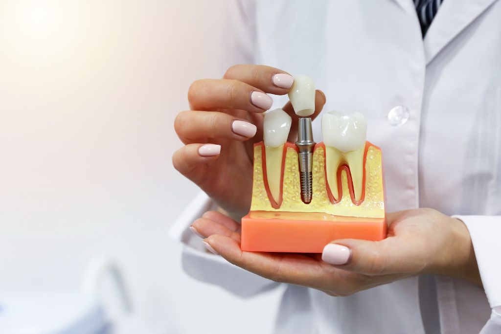 Dental Implant Recovery Process: What You Need To Know Before Getting ...